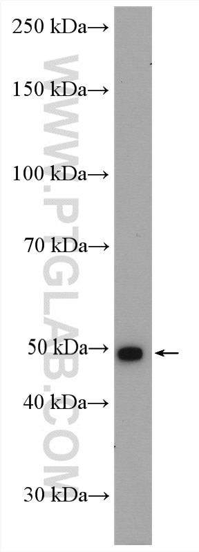 WB analysis of T-47D using 26536-1-AP