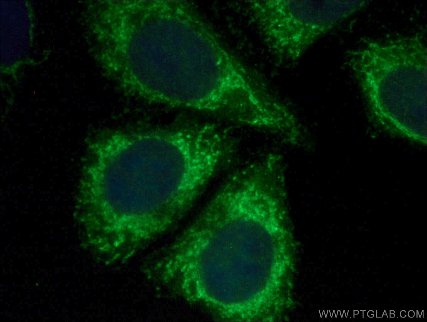 Immunofluorescence (IF) / fluorescent staining of HepG2 cells using PMPCB Polyclonal antibody (16064-1-AP)