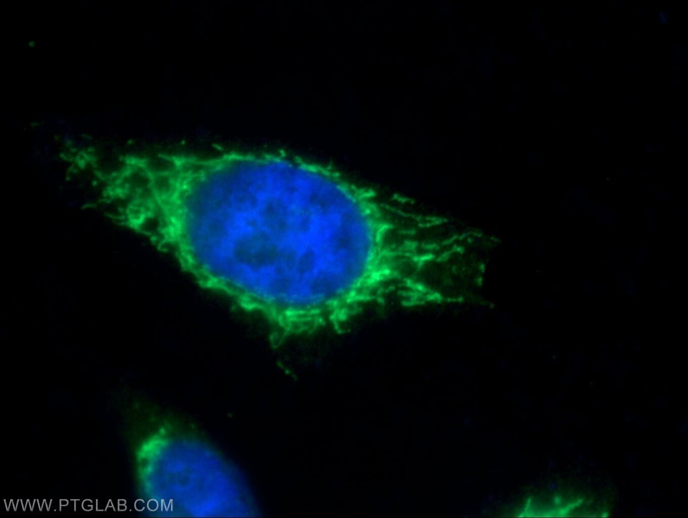 Immunofluorescence (IF) / fluorescent staining of HepG2 cells using PMPCB Polyclonal antibody (16064-1-AP)