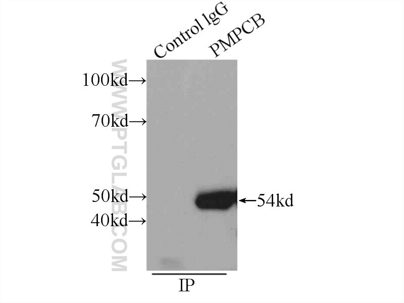 Immunoprecipitation (IP) experiment of MCF-7 cells using PMPCB Polyclonal antibody (16064-1-AP)