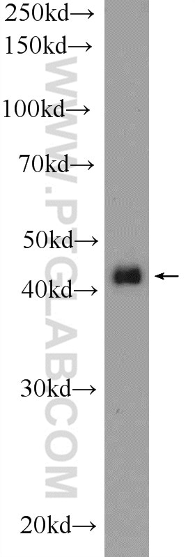 Western Blot (WB) analysis of MCF-7 cells using PMPCB Polyclonal antibody (16064-1-AP)