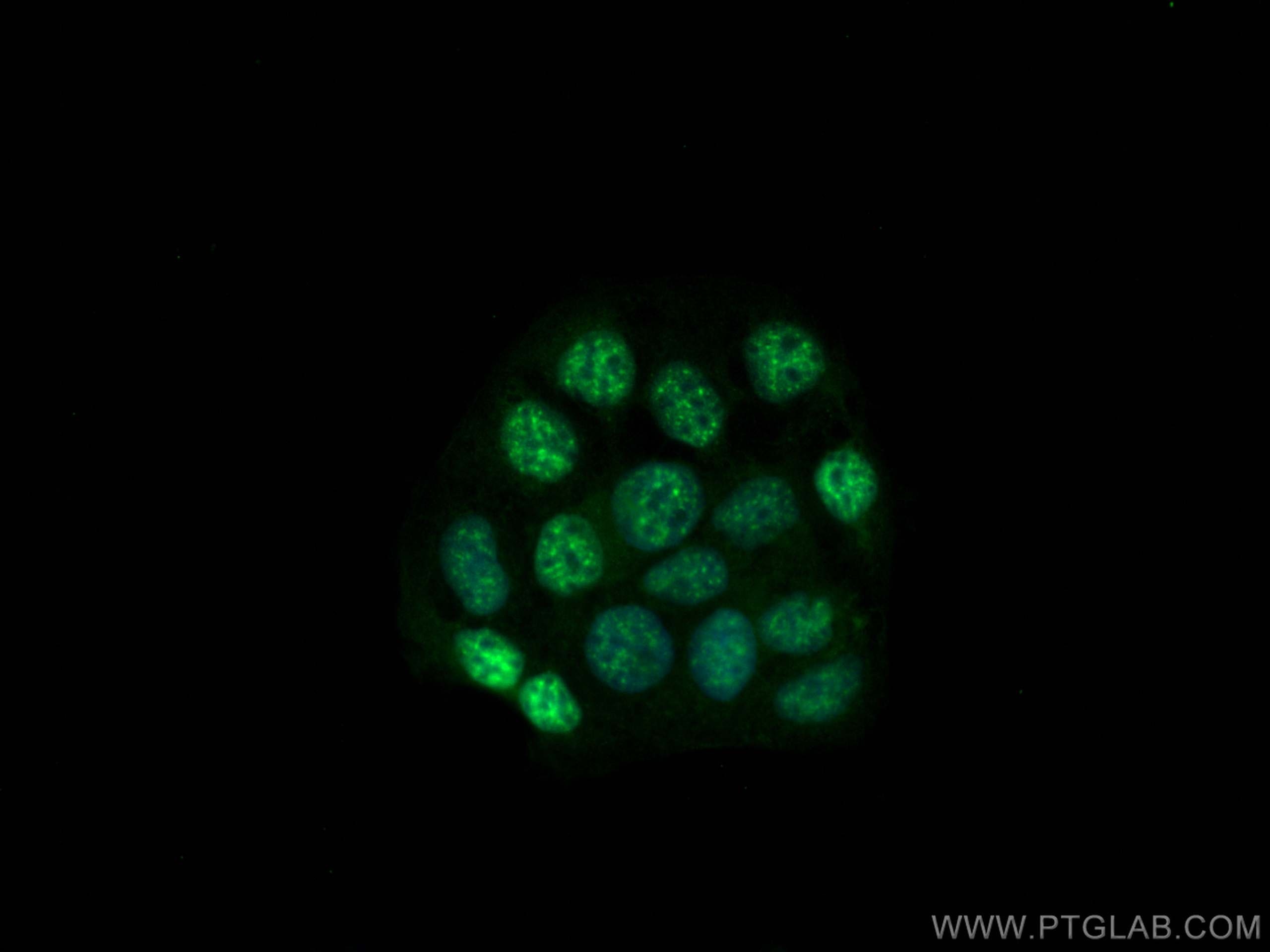 Immunofluorescence (IF) / fluorescent staining of Caco-2 cells using PMS1 Polyclonal antibody (28186-1-AP)