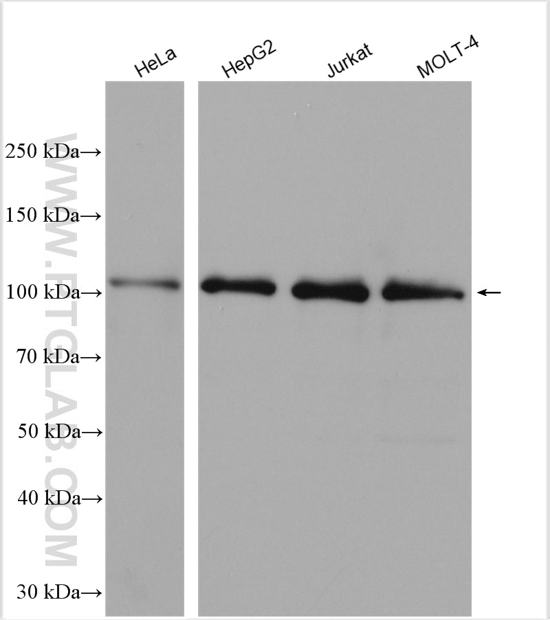 Western Blot (WB) analysis of various lysates using PMS1 Polyclonal antibody (28186-1-AP)