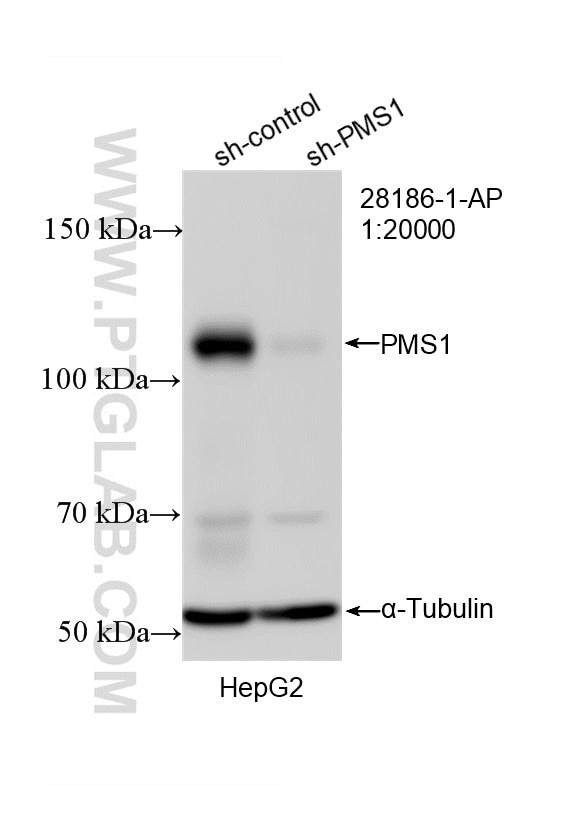 Western Blot (WB) analysis of HepG2 cells using PMS1 Polyclonal antibody (28186-1-AP)