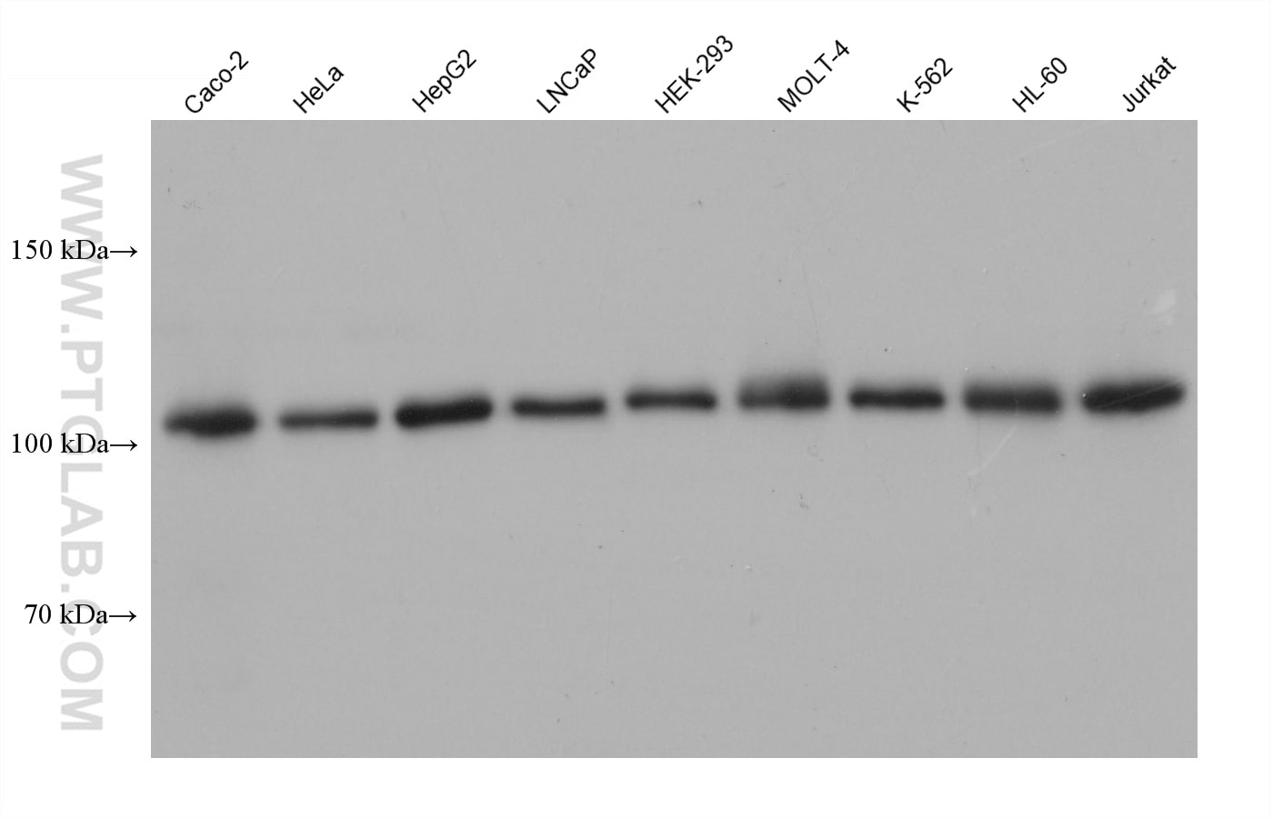 Western Blot (WB) analysis of various lysates using PMS1 Monoclonal antibody (68413-1-Ig)