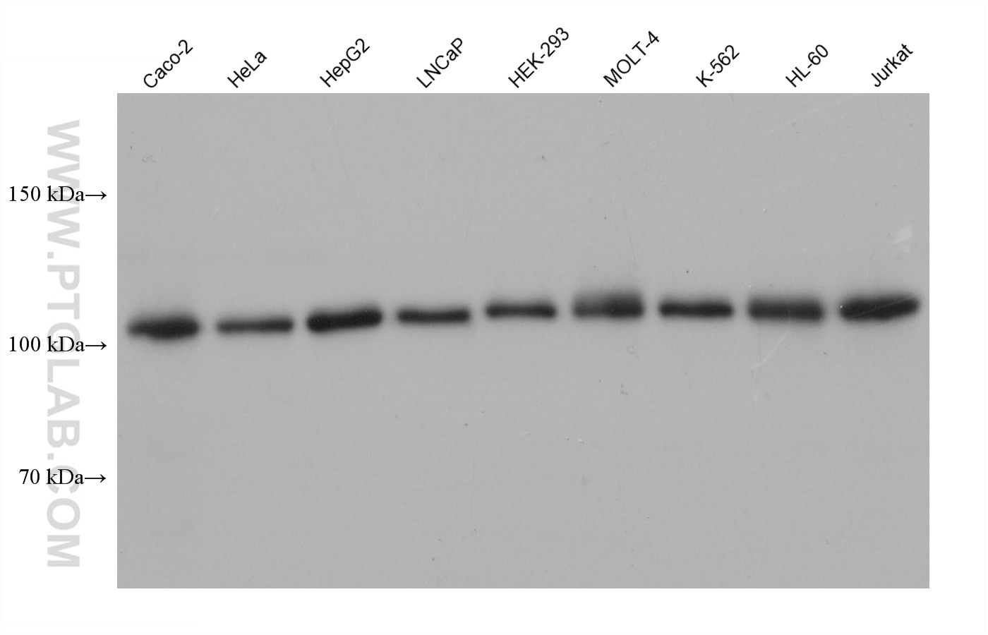 WB analysis using 68413-1-Ig