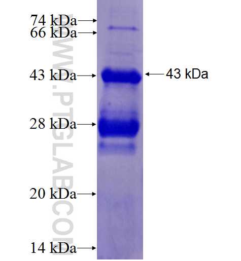 PMS1 fusion protein Ag1158 SDS-PAGE