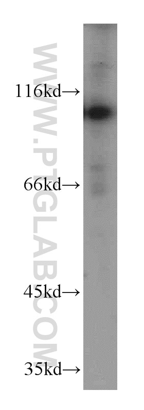 Western Blot (WB) analysis of PC-3 cells using PMS2 Polyclonal antibody (18164-1-AP)