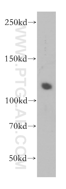 Western Blot (WB) analysis of PC-3 cells using PMS2 Polyclonal antibody (18164-1-AP)