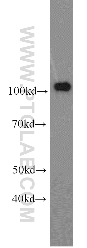 Western Blot (WB) analysis of A431 cells using PMS2 Monoclonal antibody (66075-1-Ig)