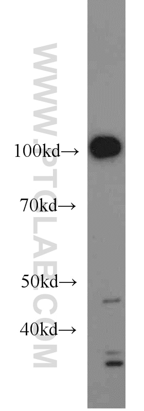 Western Blot (WB) analysis of HeLa cells using PMS2 Monoclonal antibody (66075-1-Ig)