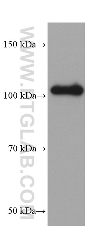 Western Blot (WB) analysis of rabbit brain tissue using PMS2 Monoclonal antibody (68905-5-Ig)