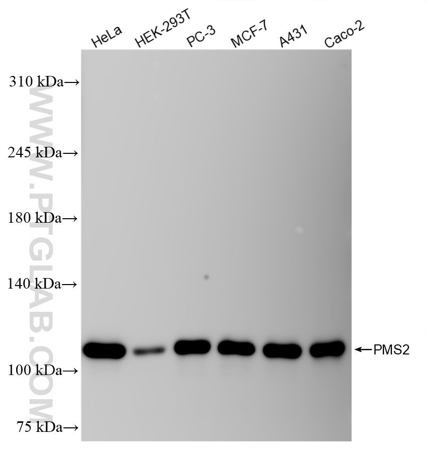 Western Blot (WB) analysis of various lysates using PMS2 Recombinant antibody (84894-5-RR)