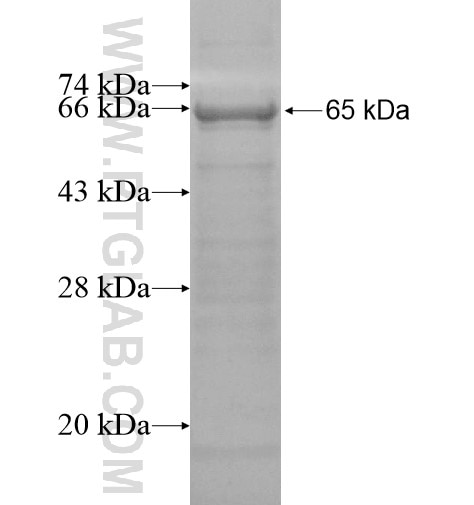 PMS2 fusion protein Ag12651 SDS-PAGE