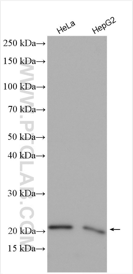 Western Blot (WB) analysis of various lysates using PMVK Polyclonal antibody (15674-1-AP)