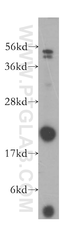 Western Blot (WB) analysis of HeLa cells using PMVK Polyclonal antibody (15674-1-AP)