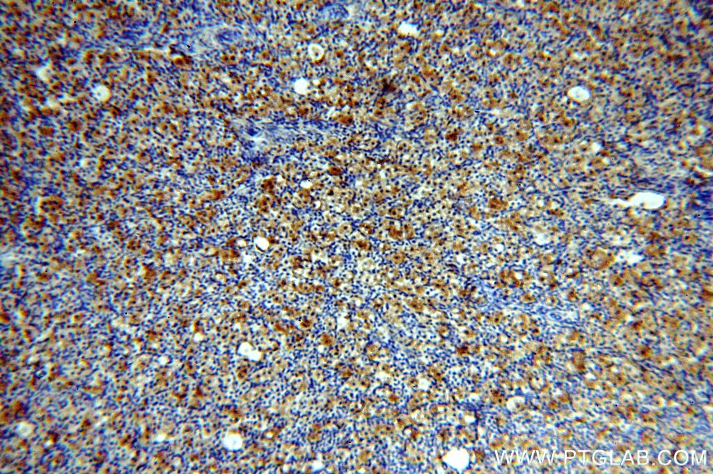 Immunohistochemistry (IHC) staining of human ovary tissue using PNCK Polyclonal antibody (13712-1-AP)