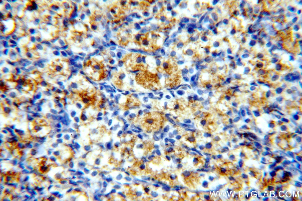 Immunohistochemistry (IHC) staining of human ovary tissue using PNCK Polyclonal antibody (13712-1-AP)