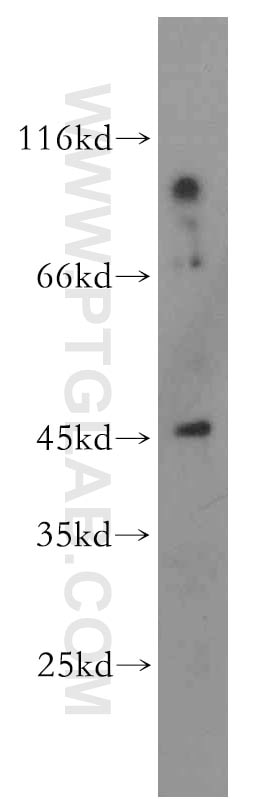 Western Blot (WB) analysis of human brain tissue using PNCK Polyclonal antibody (13712-1-AP)