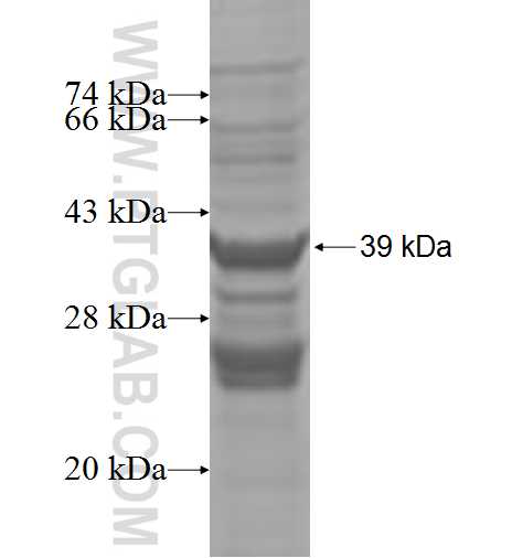 PNCK fusion protein Ag4650 SDS-PAGE