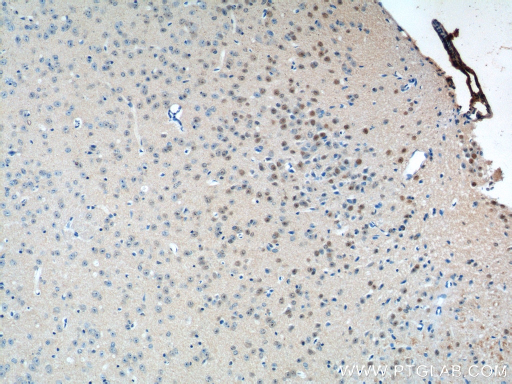 Immunohistochemistry (IHC) staining of mouse brain tissue using PNKD Polyclonal antibody (11584-1-AP)
