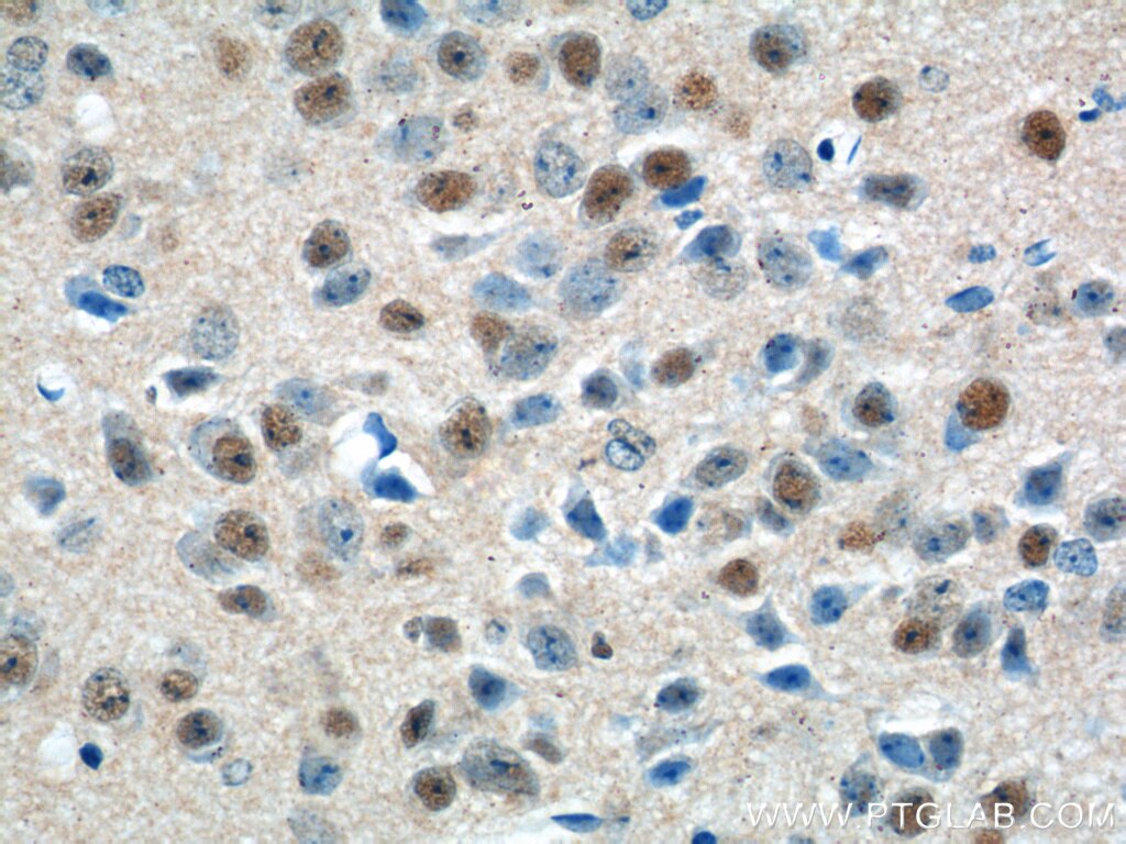 Immunohistochemistry (IHC) staining of mouse brain tissue using PNKD Polyclonal antibody (11584-1-AP)