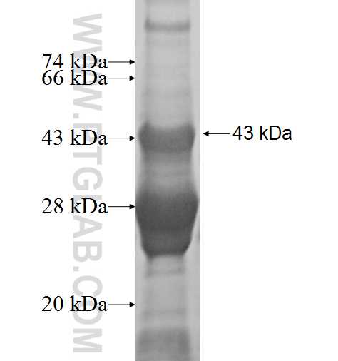 PNKD fusion protein Ag2176 SDS-PAGE