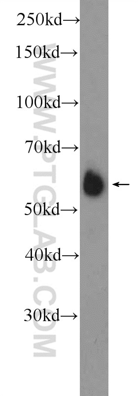 Western Blot (WB) analysis of HeLa cells using PNKP Polyclonal antibody (13558-1-AP)