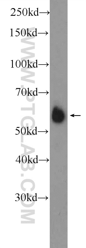 WB analysis of HeLa using 13558-1-AP