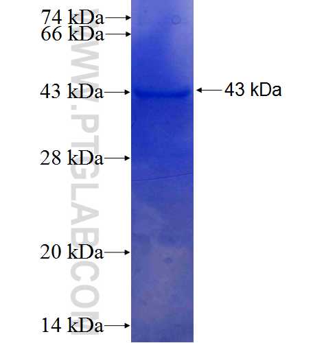 PNKP fusion protein Ag4703 SDS-PAGE