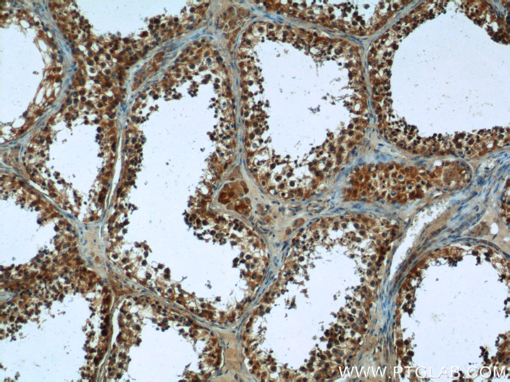 Immunohistochemistry (IHC) staining of human testis tissue using PNLDC1 Polyclonal antibody (25559-1-AP)