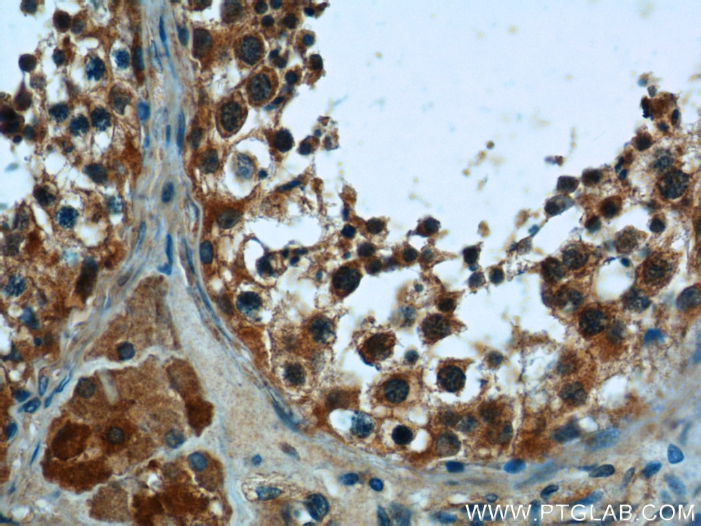 Immunohistochemistry (IHC) staining of human testis tissue using PNLDC1 Polyclonal antibody (25559-1-AP)