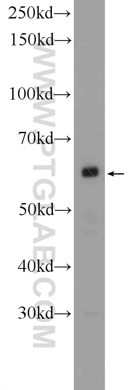 Western Blot (WB) analysis of Raji cells using PNLDC1 Polyclonal antibody (25559-1-AP)