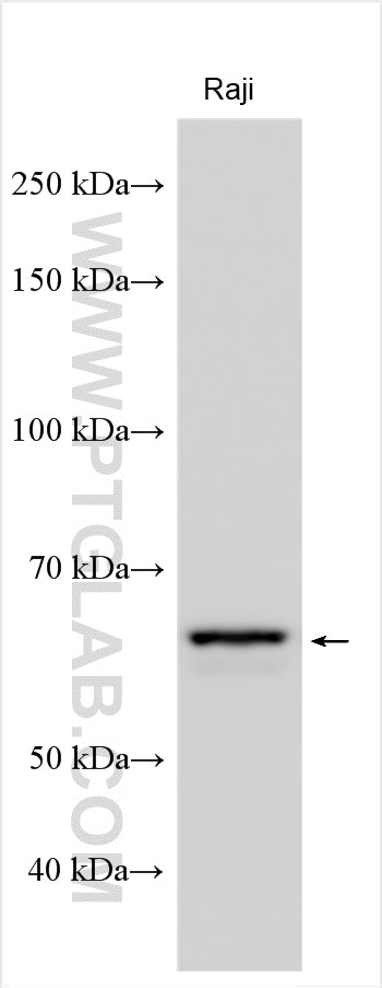 Western Blot (WB) analysis of various lysates using PNLDC1 Polyclonal antibody (25559-1-AP)