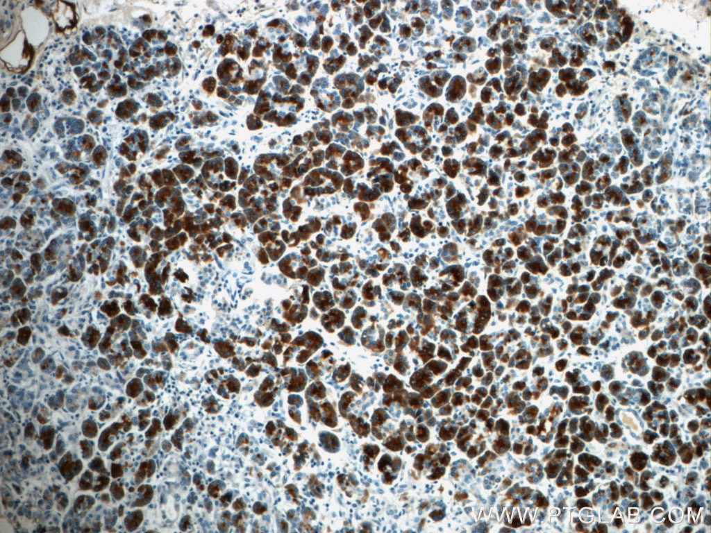 Immunohistochemistry (IHC) staining of human pancreas tissue using Pancreatic Lipase Polyclonal antibody (11209-1-AP)