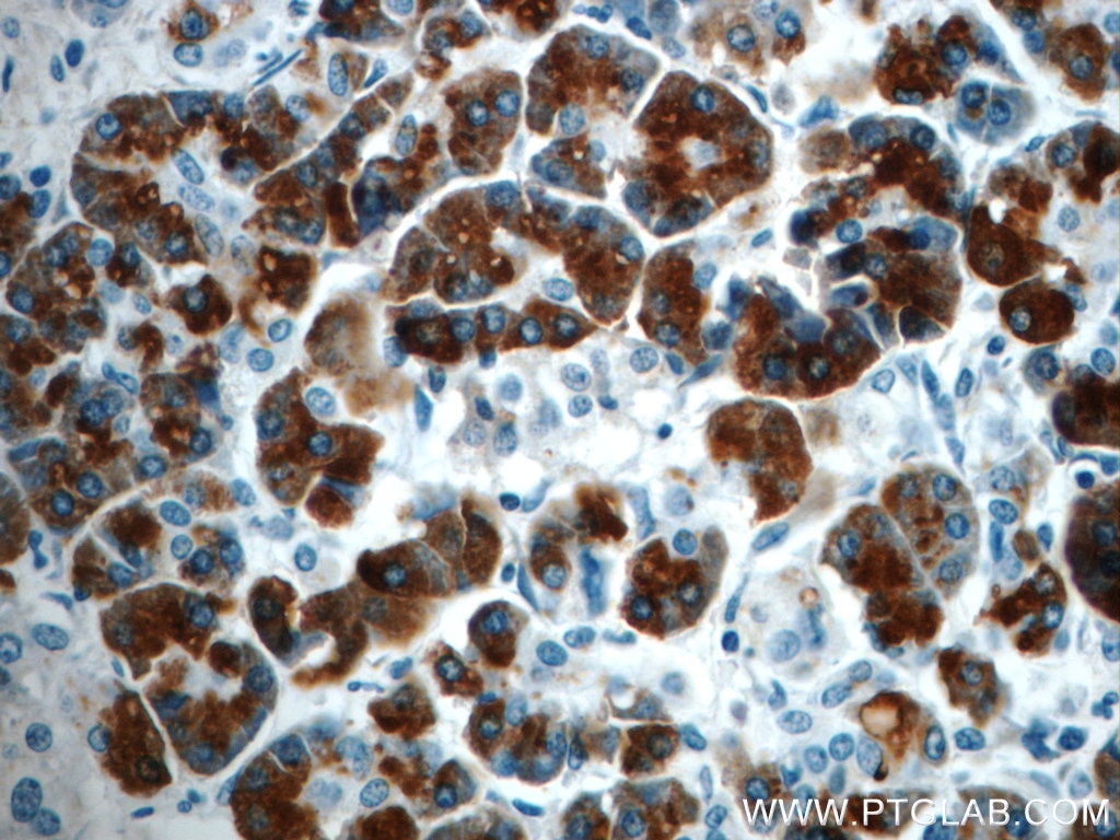 Immunohistochemistry (IHC) staining of human pancreas tissue using Pancreatic Lipase Polyclonal antibody (11209-1-AP)
