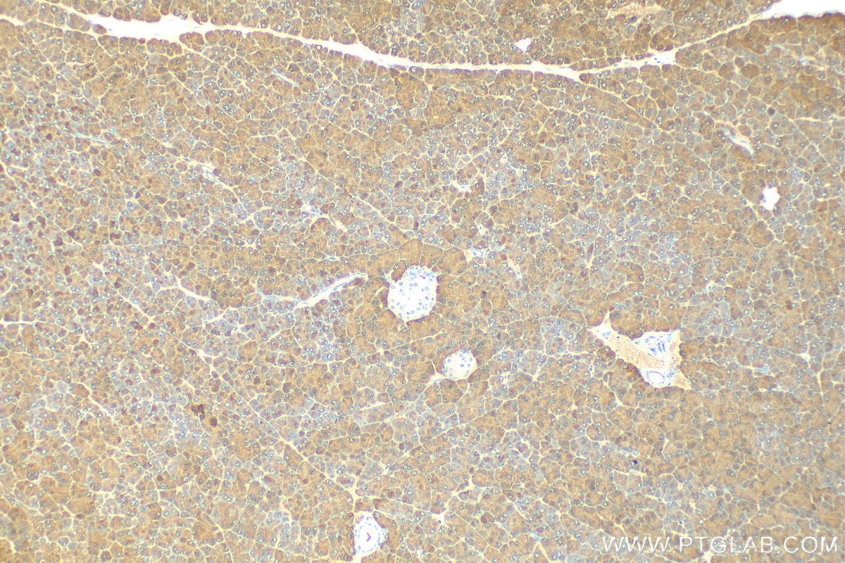 Immunohistochemistry (IHC) staining of mouse pancreas tissue using Pancreatic Lipase Polyclonal antibody (11209-1-AP)