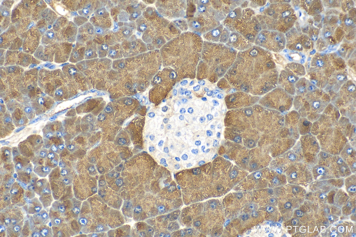 Immunohistochemistry (IHC) staining of mouse pancreas tissue using Pancreatic Lipase Polyclonal antibody (11209-1-AP)