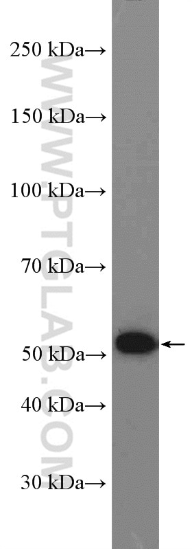 Western Blot (WB) analysis of BxPC-3 cells using Pancreatic Lipase Polyclonal antibody (11209-1-AP)