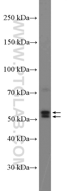 Pancreatic Lipase