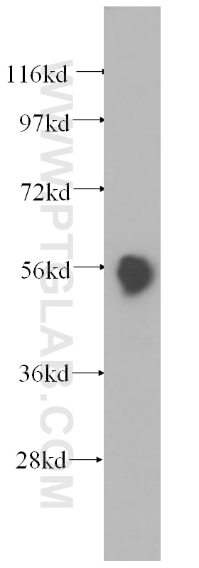 Western Blot (WB) analysis of human pancreas tissue using Pancreatic Lipase Polyclonal antibody (11209-1-AP)