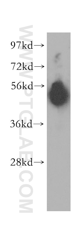 Western Blot (WB) analysis of mouse pancreas tissue using Pancreatic Lipase Polyclonal antibody (11209-1-AP)
