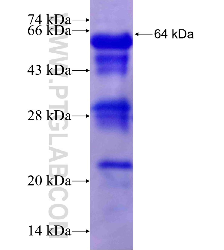 PNLIP fusion protein Ag1681 SDS-PAGE
