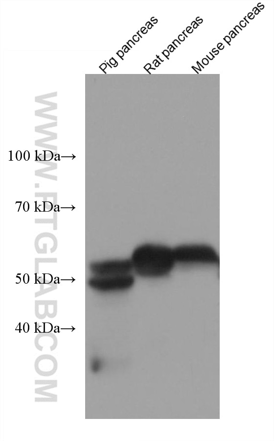 Western Blot (WB) analysis of various lysates using PNLIPRP1 Monoclonal antibody (67603-1-Ig)