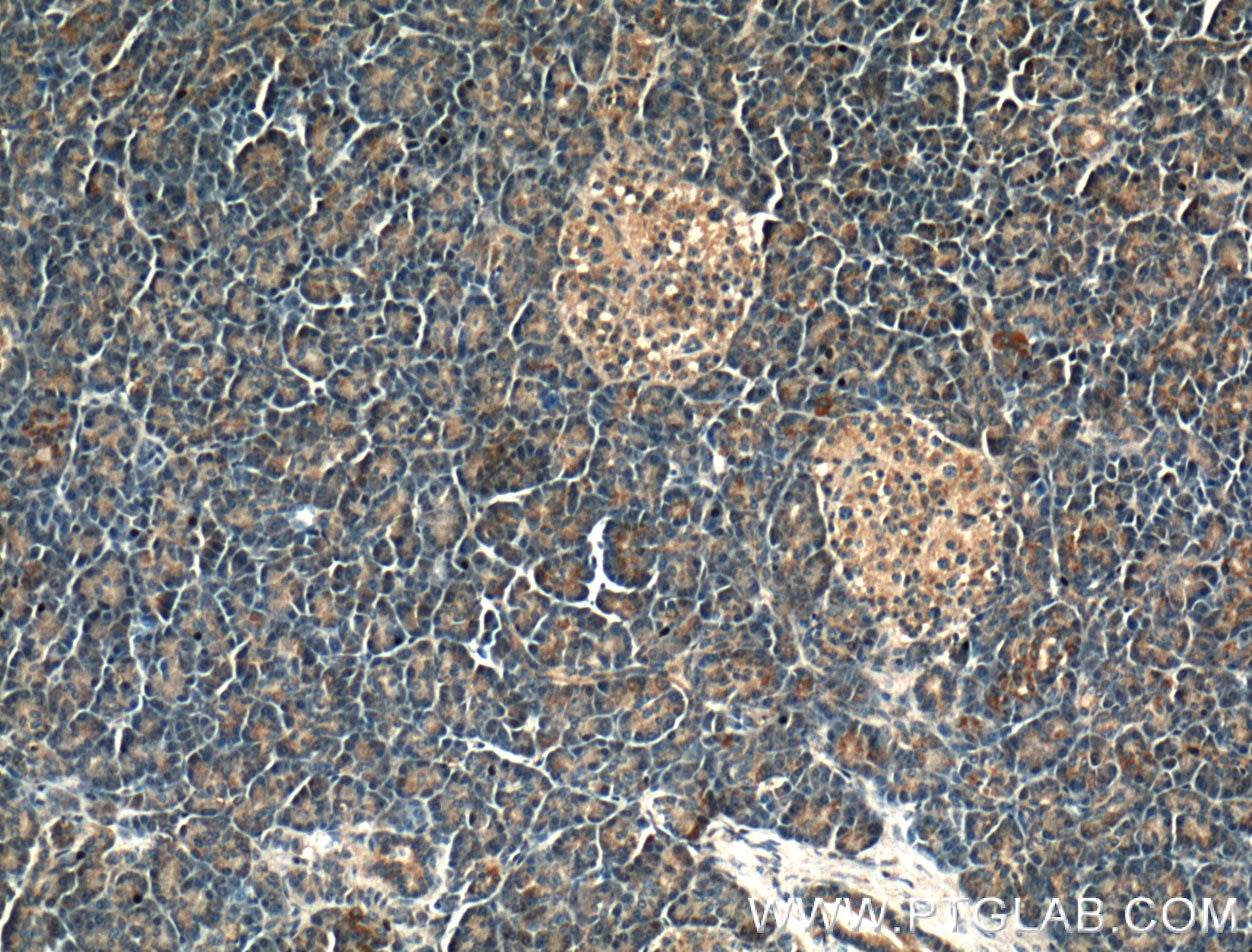 Immunohistochemistry (IHC) staining of human pancreas tissue using PNLIPRP2 Polyclonal antibody (26218-1-AP)