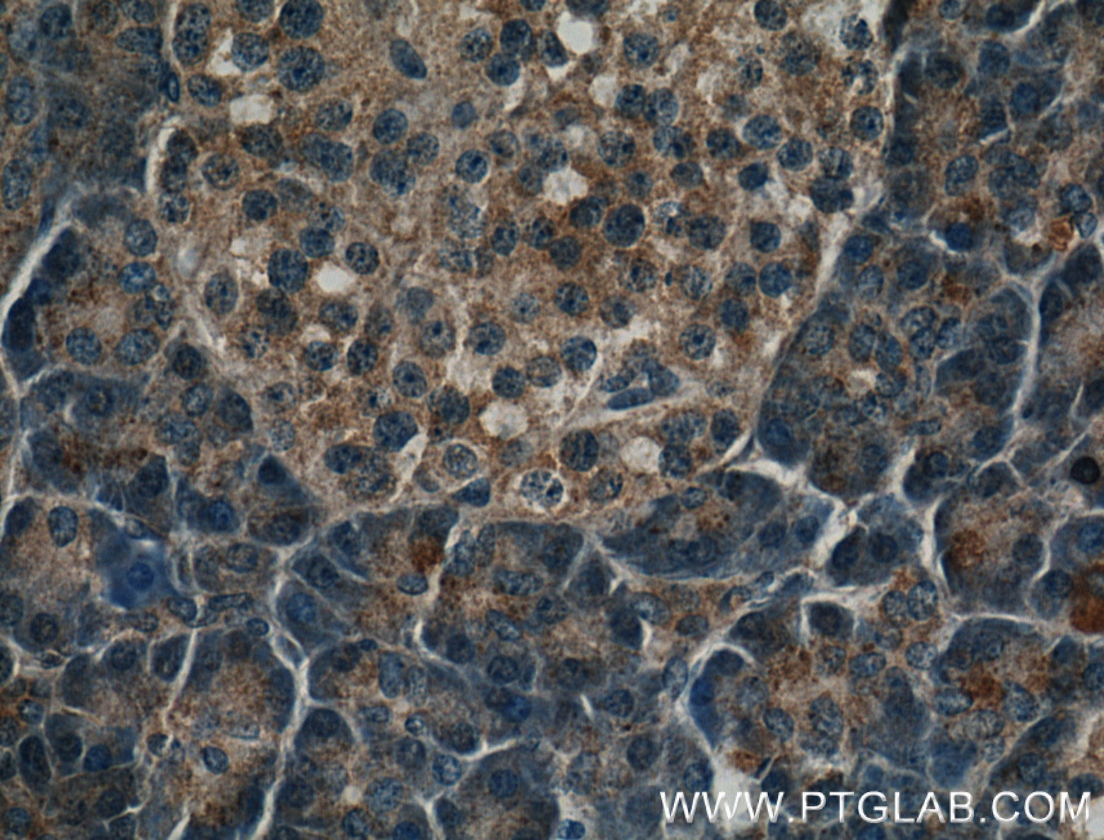 IHC staining of human pancreas using 26218-1-AP