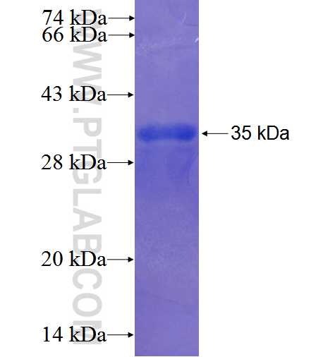 PNLIPRP2 fusion protein Ag23967 SDS-PAGE