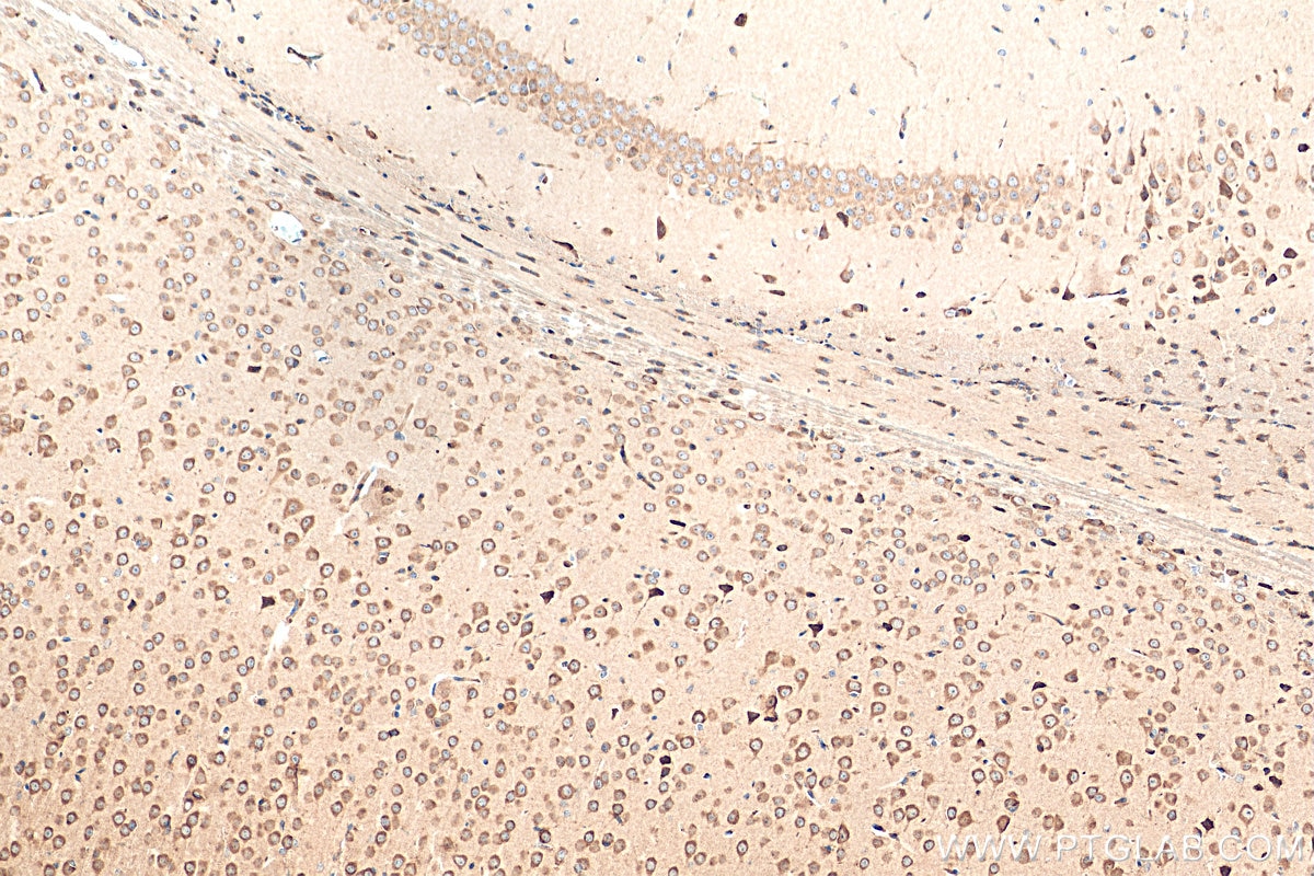 Immunohistochemistry (IHC) staining of mouse brain tissue using PNMA1 Polyclonal antibody (13631-1-AP)