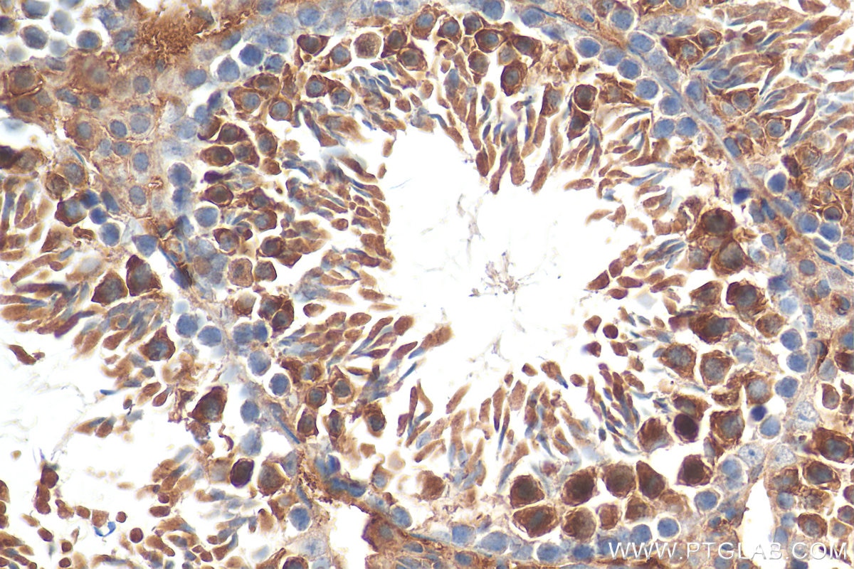 Immunohistochemistry (IHC) staining of mouse testis tissue using PNMA1 Polyclonal antibody (13631-1-AP)