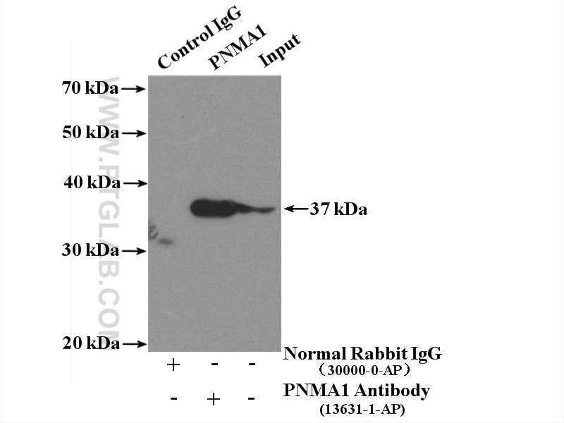 IP experiment of mouse testis using 13631-1-AP